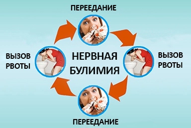 Лечение булимии в Катав-Ивановске